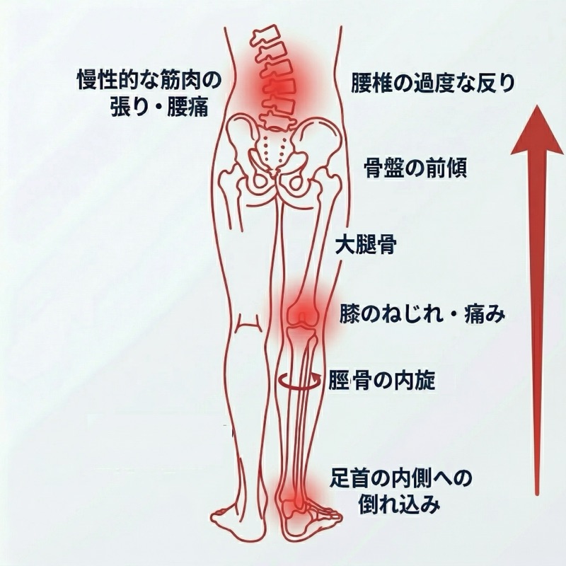 足元から腰痛への連鎖