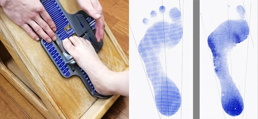 詳細な足測定と足型診断