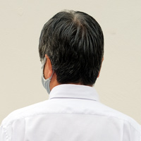 Uさん 50代 男性