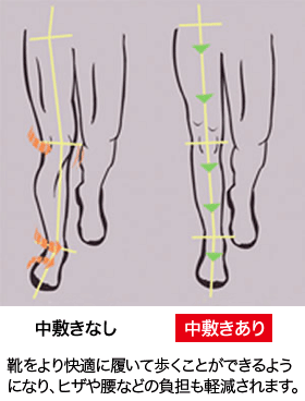 インソールは足を安定させ、全身のバランスを整えます