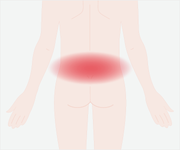 腰痛の症状
