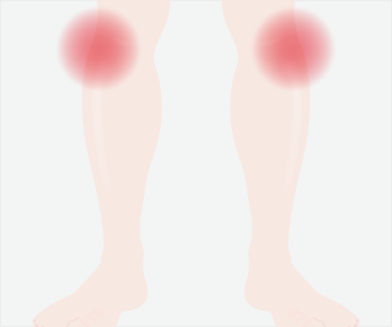 腸脛靭帯炎の症状