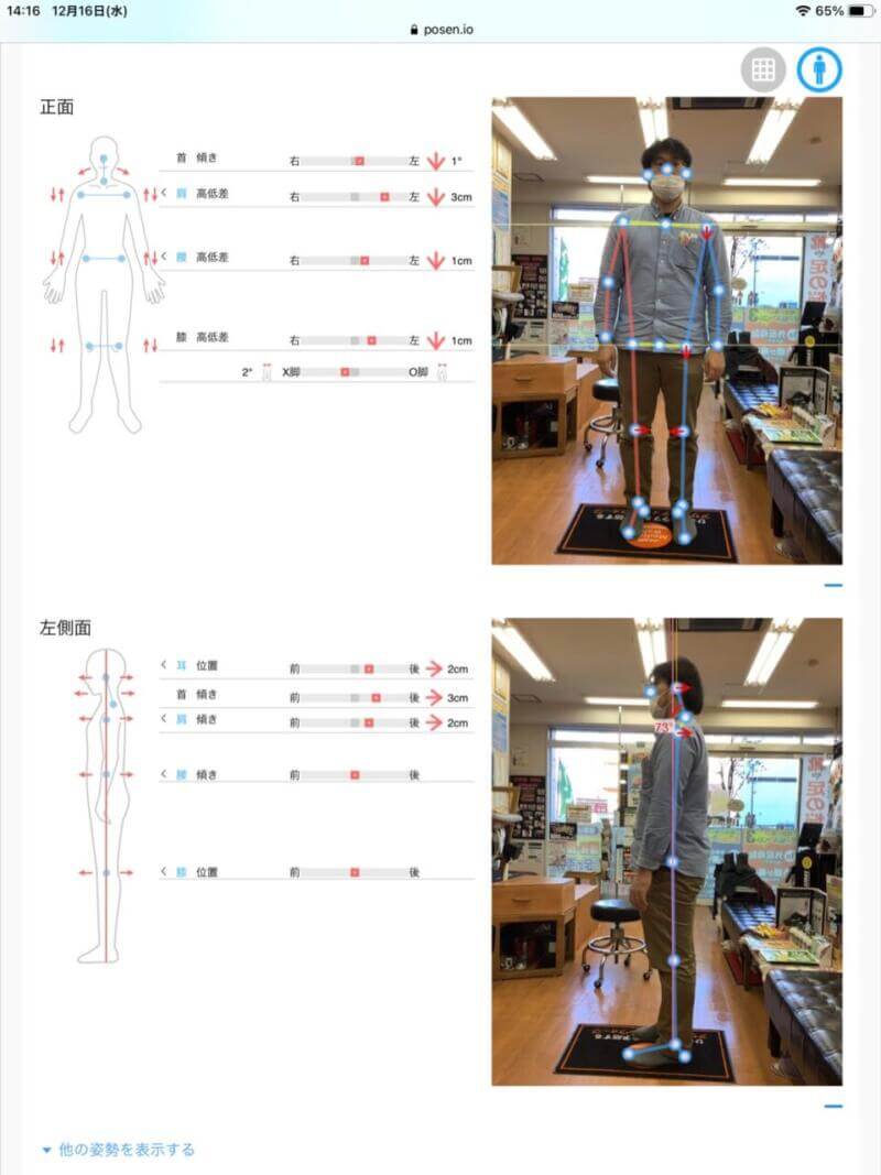 姿勢診断例題