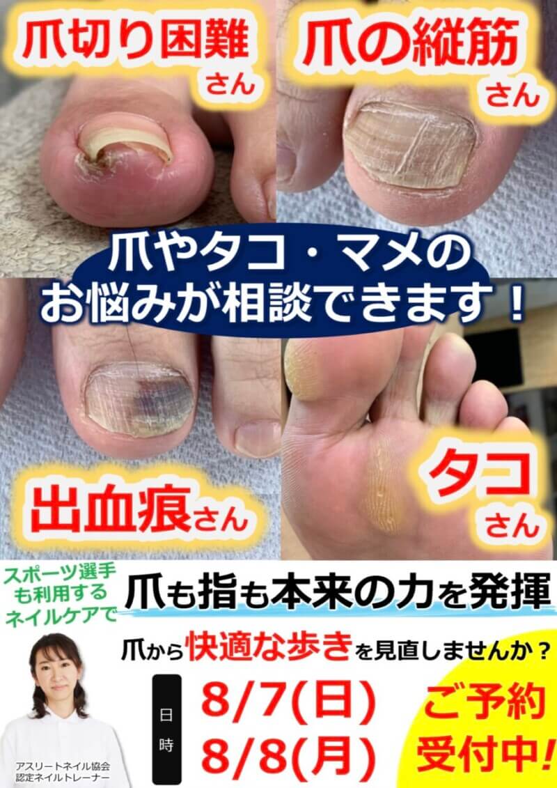 爪とタコマメのケアしてますか？