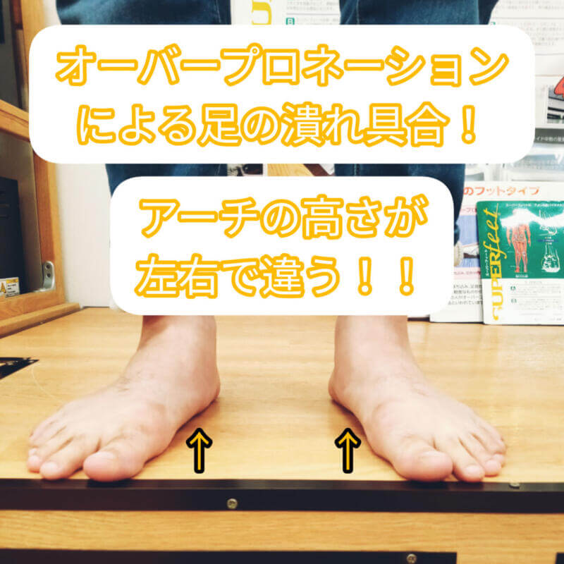 すぐわかる足診断👣