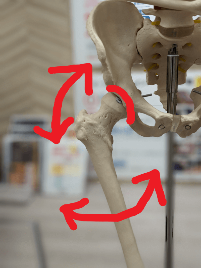 股関節の痛み（変形性股関節症）の原因とインソール