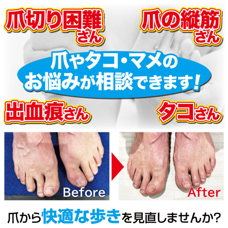 サンダルの前にフットケア