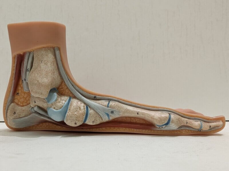 扁平足とひざ痛の関係性