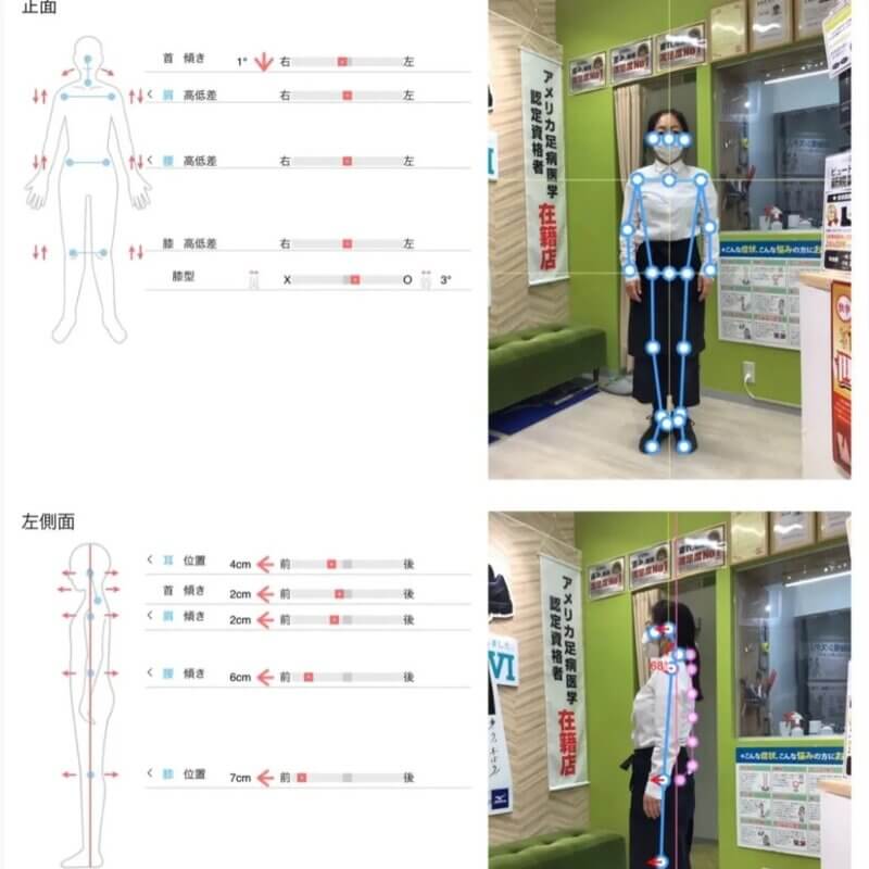 姿勢改善でアンチエイジング!