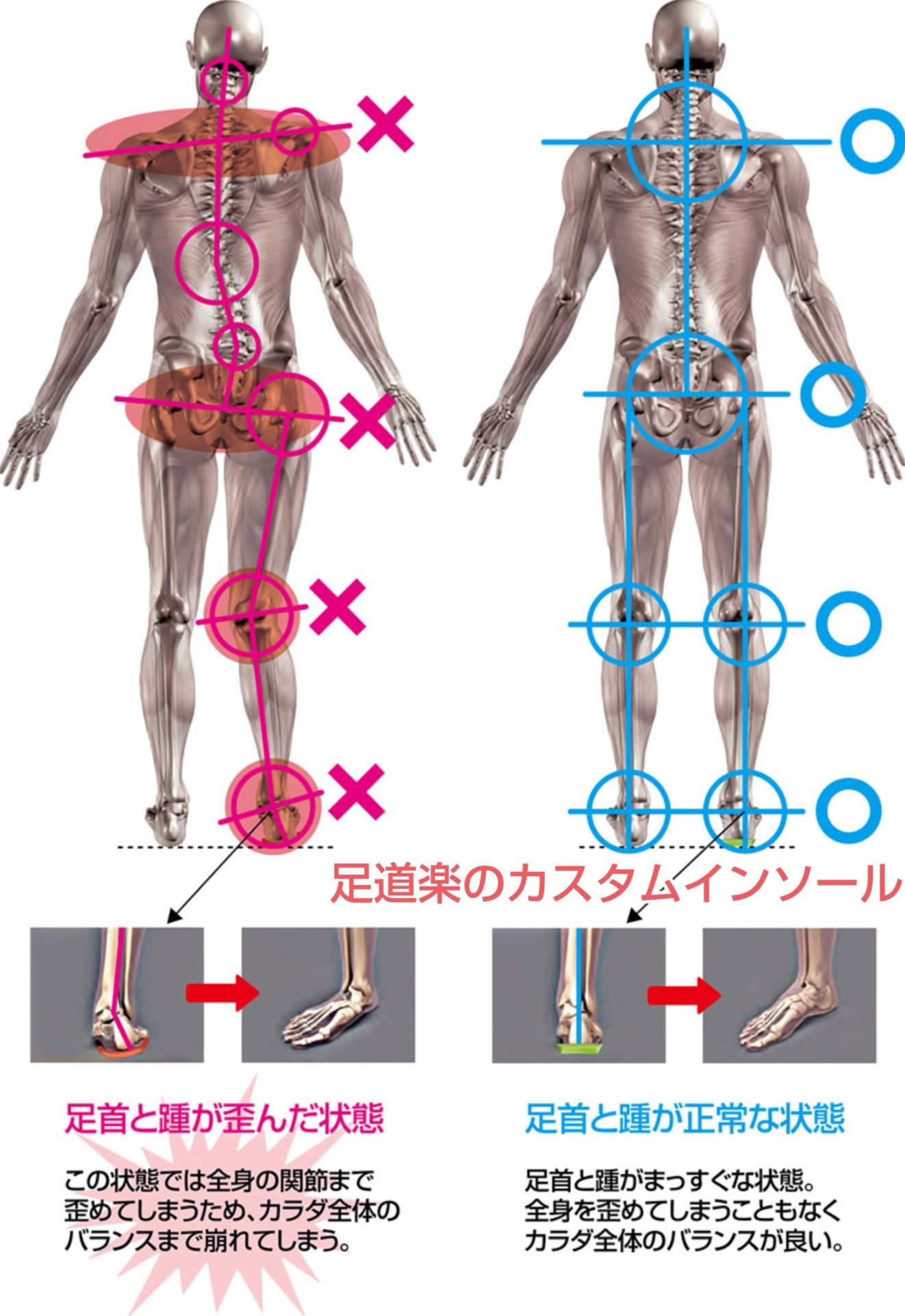 ランナー膝 オーダーメイドの特許インソールと正しい靴選びのお店 足道楽