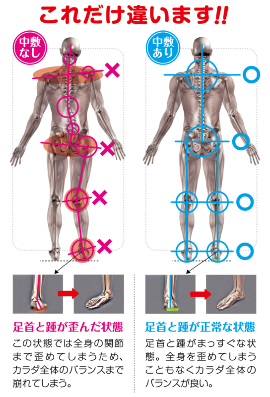 足 の 歪み