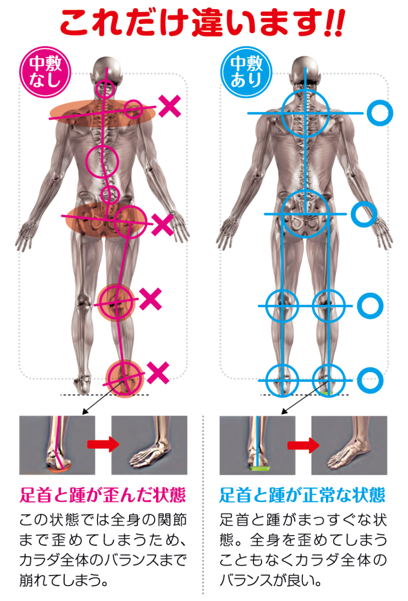 足の歪みが体の歪み、歩き方にも影響！