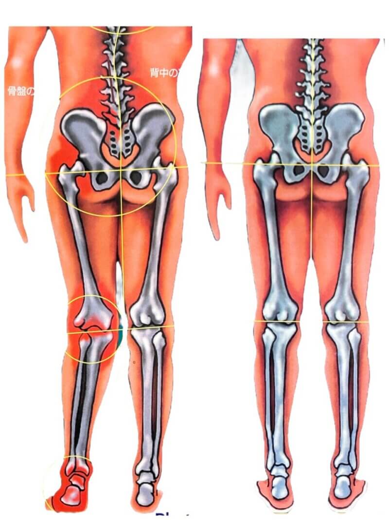 ひざの痛みは足首から改善できる!