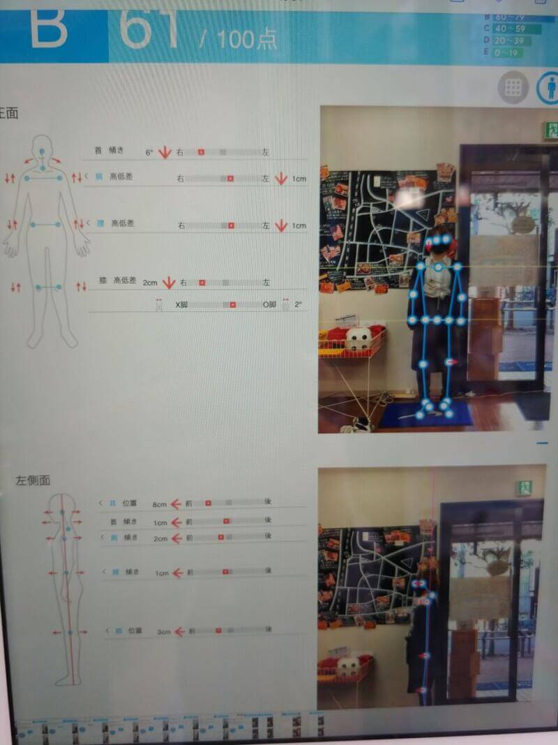 インソールで姿勢の歪みが変わる！